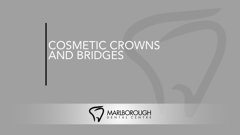 Cosmetic Crowns and Bridges